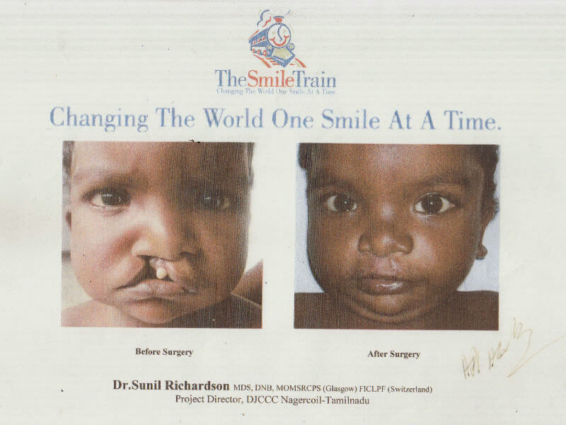 The Smile Train Nagercoil