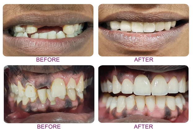 dental 1