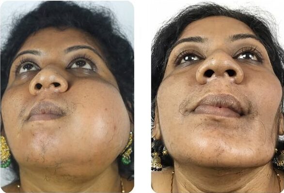 facial trauma 1 e1783371856281
