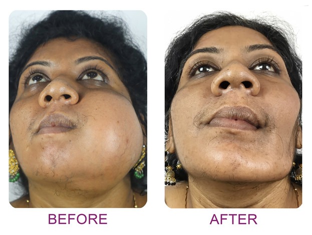 facial trauma 1