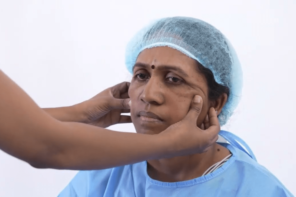 Best Facelift Surgery In Bangalore