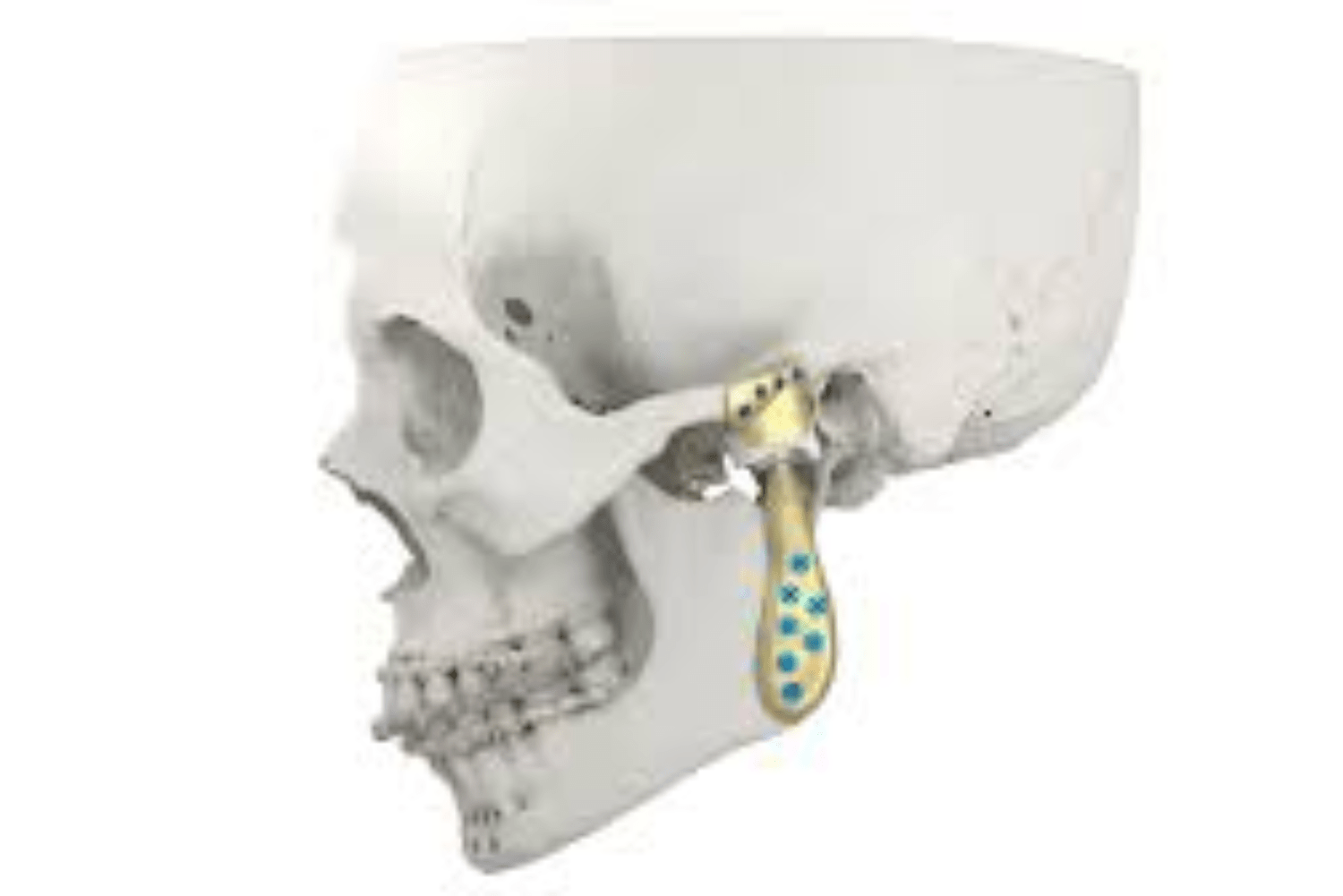 Temporomandibular joint
