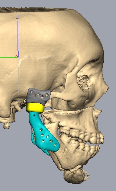 TMJ.pdf image 005