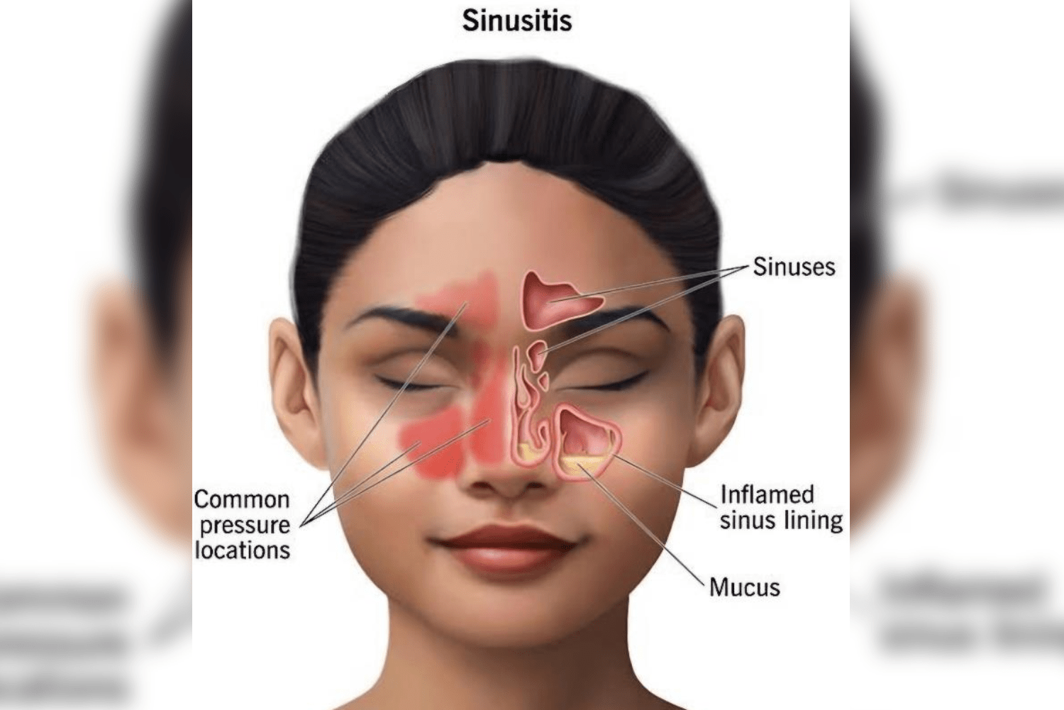 Best Sinus Surgery In Bangalore