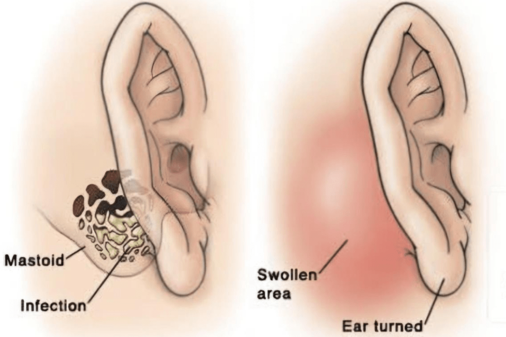 Best Ear Surgery In Bangalore