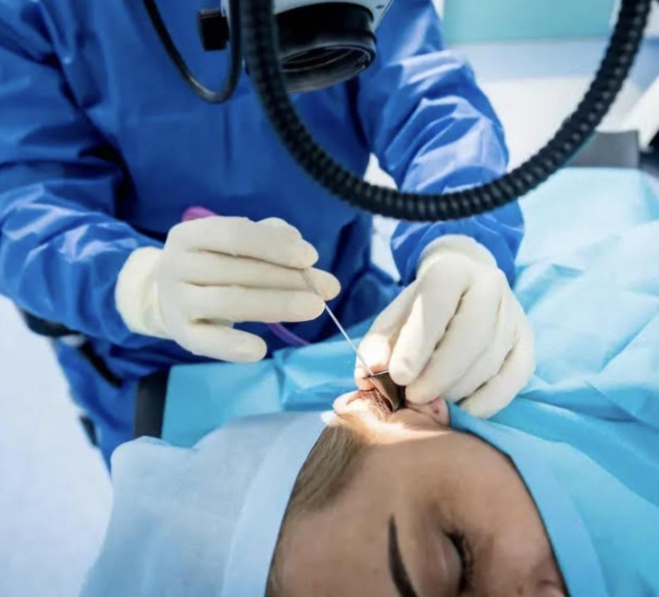 Tympanoplasty blog.pdf image 004