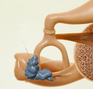 Best ENT Treatment In India