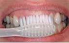 How To Prevent Cavities: Tips For Healthy Teeth