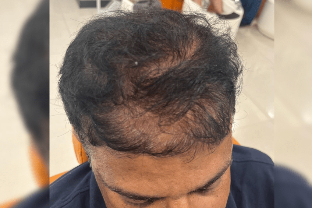 How To Control Hair Fall