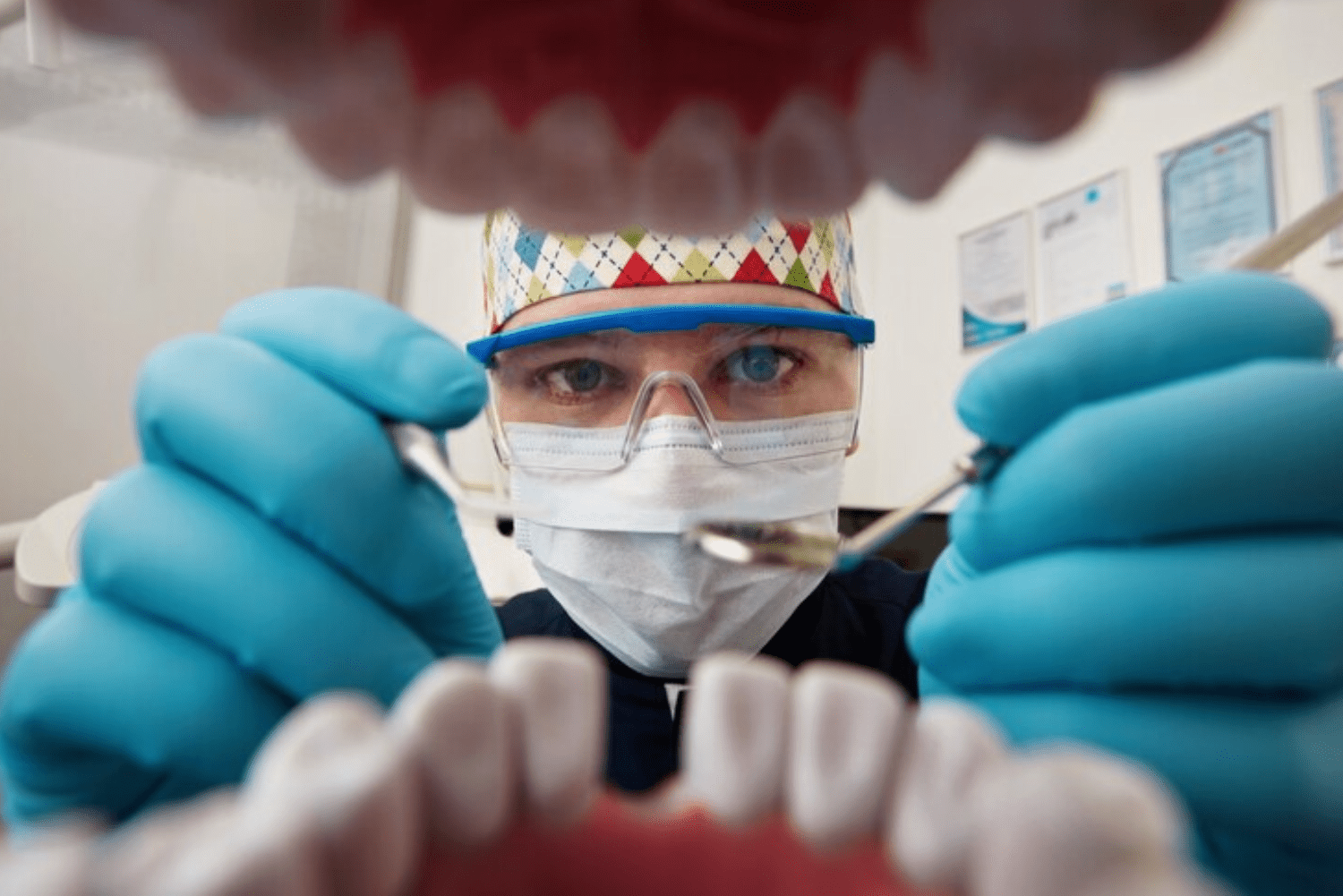 Early Diagnosis Of Oral Cancer