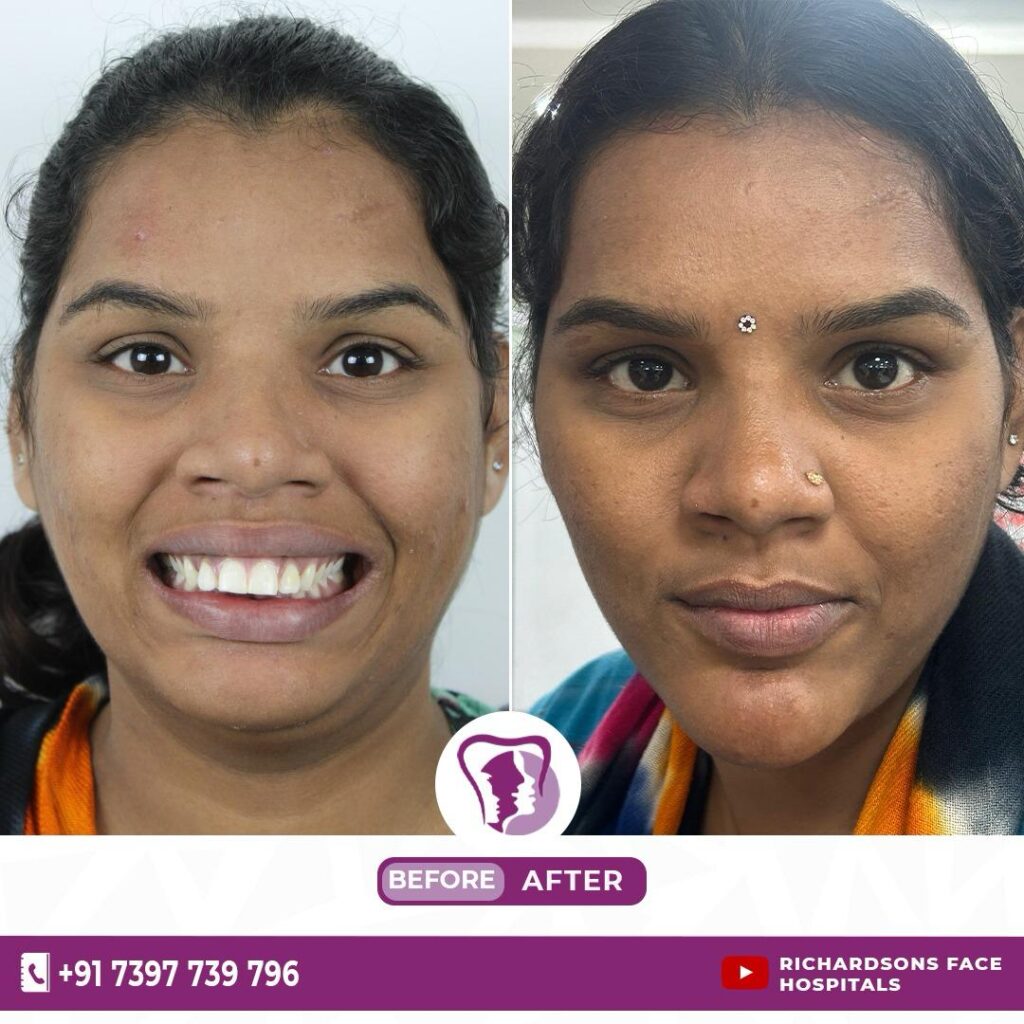 Facial Plastic Surgery- Top Procedures For A Youthful Look!