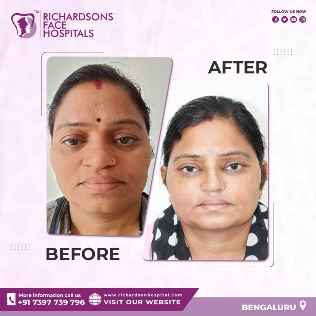 Facial Plastic Surgery- Top Procedures For A Youthful Look!