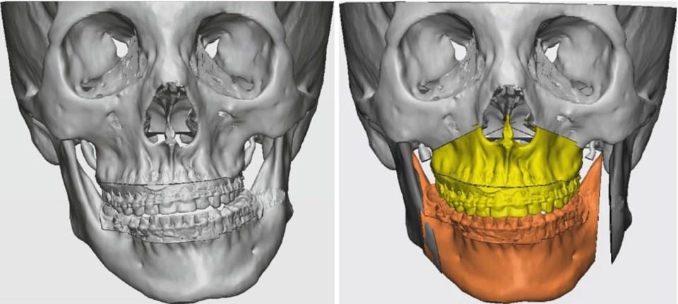 role of 3D labs in modern facial surgery