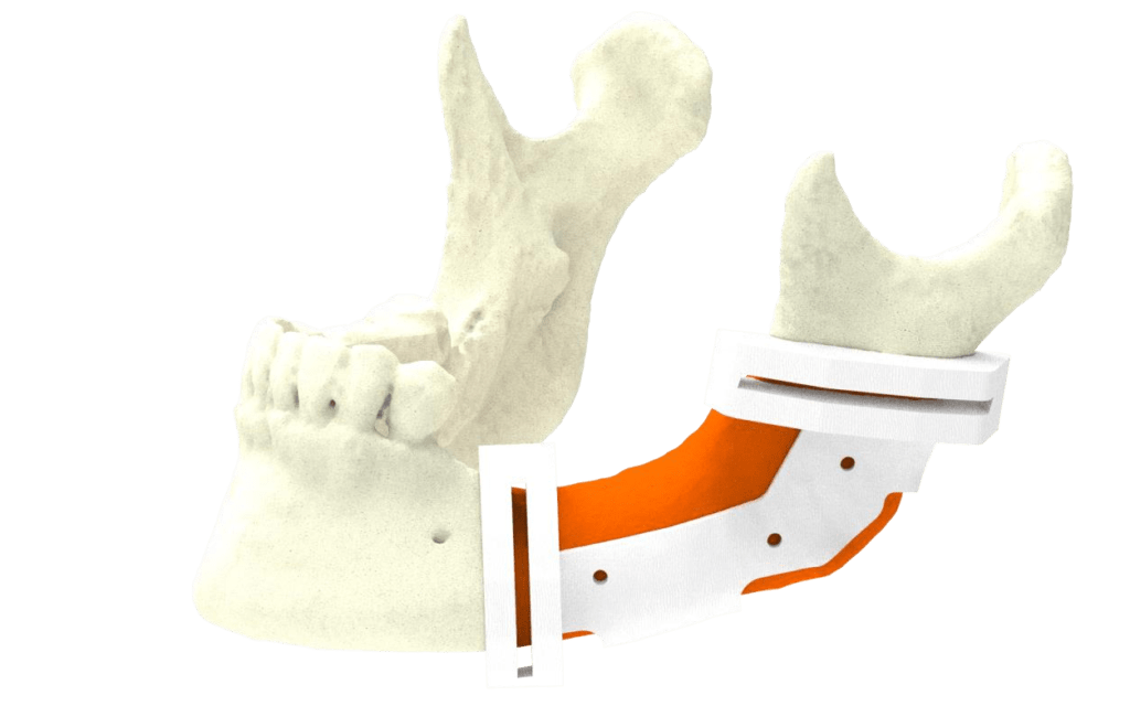 role of 3D labs in modern facial surgery