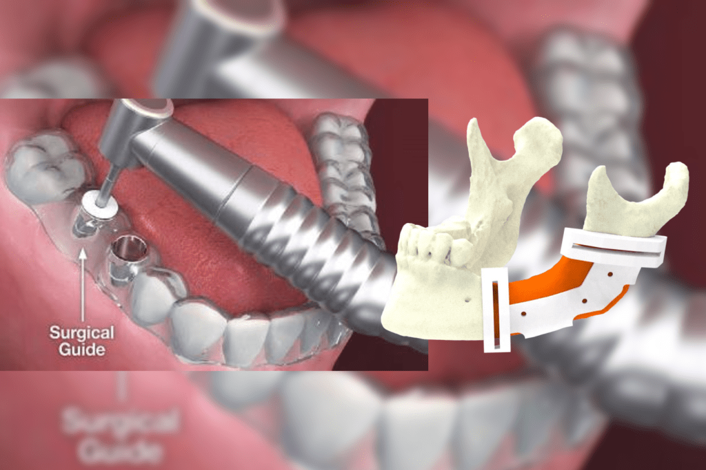 Role of 3D labs in Modern Facial Surgery