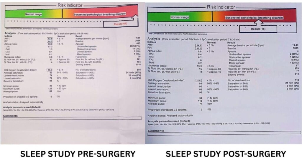 SNORE CURE 1.pdf image 000