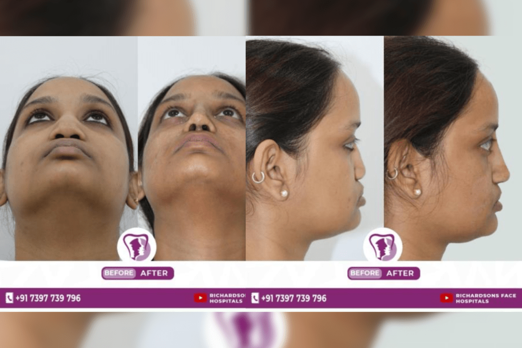 Richardsons Face Hospitals