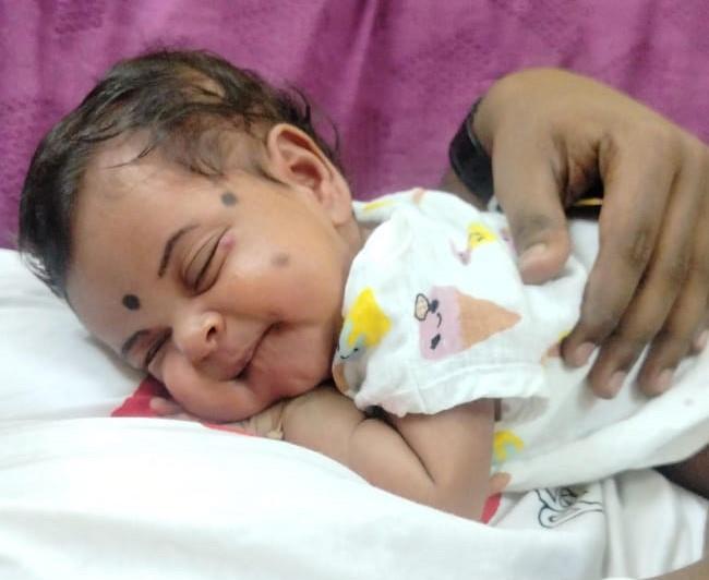 best Haemangiomas treatment in Bangalore