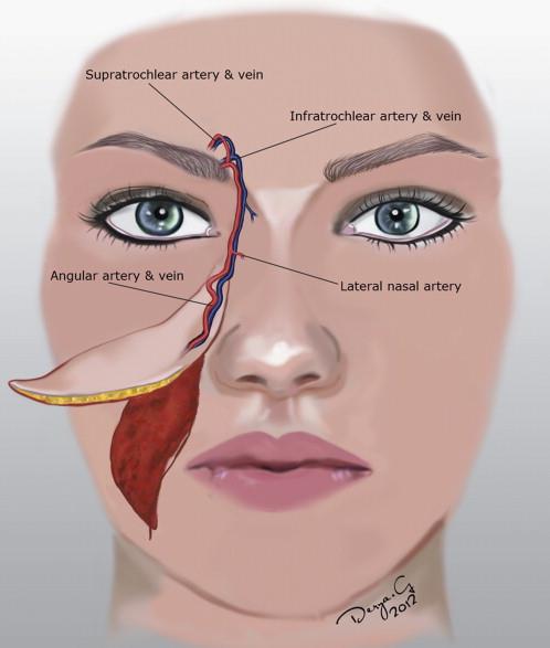 Trismus Correction Post Radiation Therapy.pdf image 000