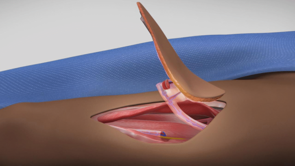 Trismus Correction Post Radiation Therapy.pdf image 003