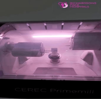 BEST TOOTH COLORED CROWNS USING CEREC PRIMESCAN AND PRIMEMILL.pdf image 009