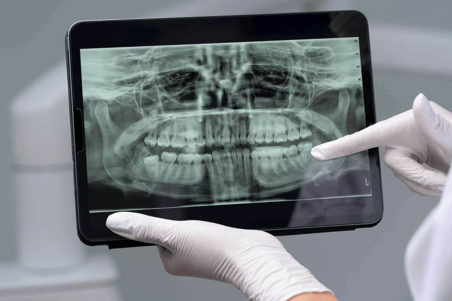 Virtual Surgical Planning