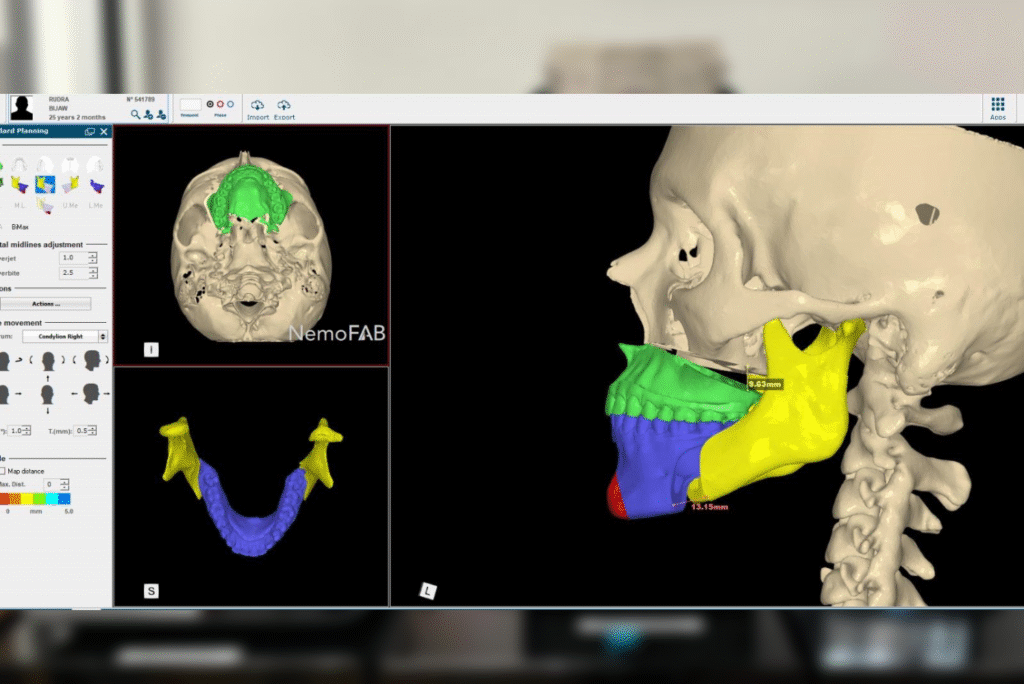 3D Printing in Healthcare