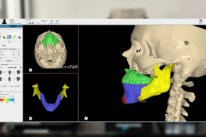 3D Printing in Healthcare