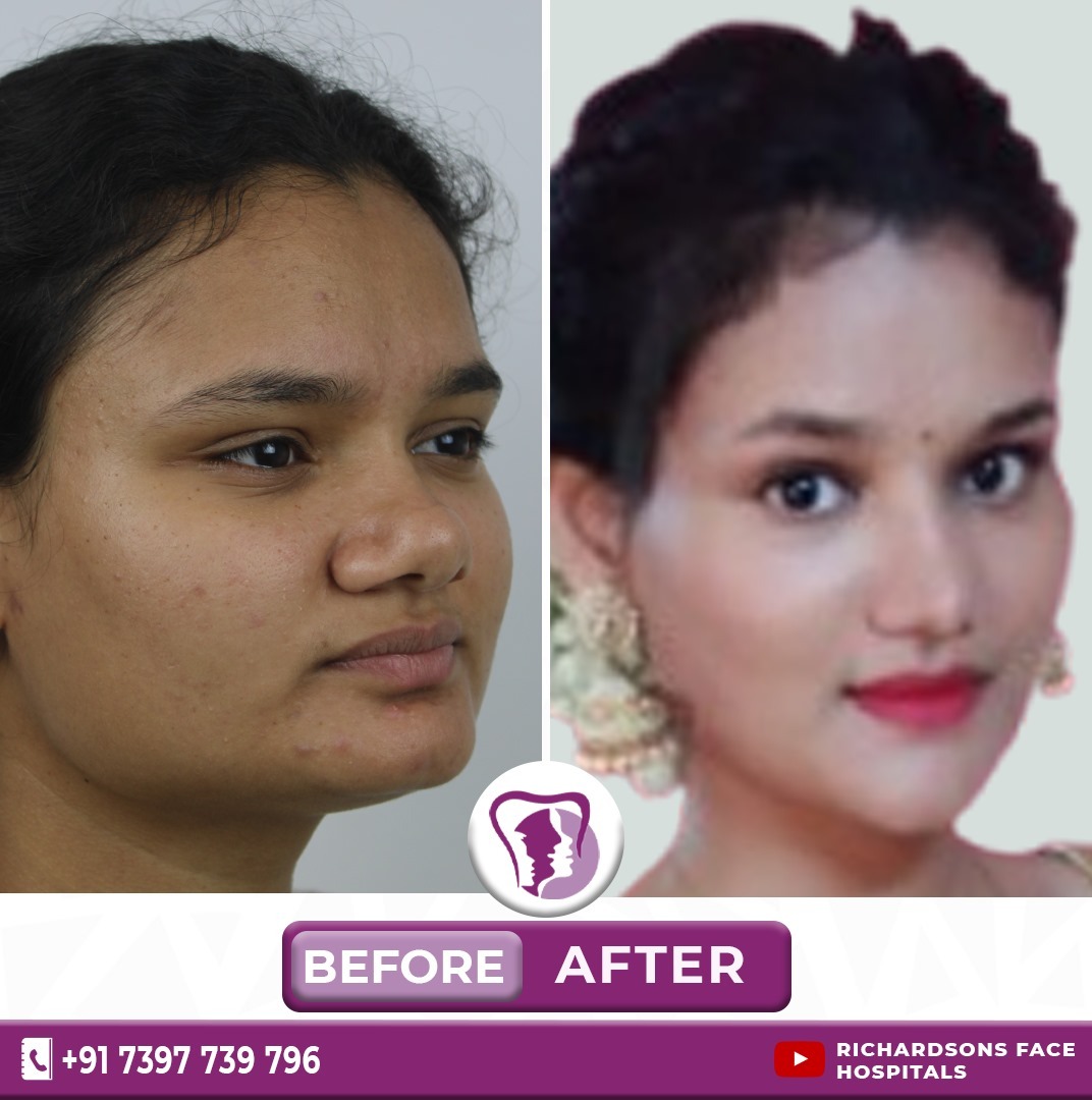 Best Orthogantic Surgery in Bangalore