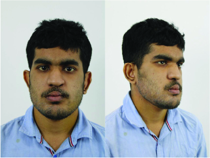 Case #1 Male Patient Post-OP