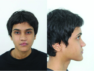 Case #3 Male Patient Post-OP