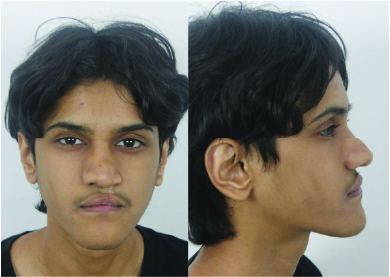 Case #3 Male Patient Pre-OP