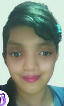 Crouzon Syndrome Case #1 Patient Post-OP