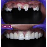 03 Smile Design 3