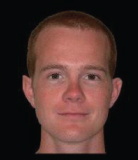 Mesoprosopic (Average Face Type)