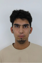 Leptoprosopic Facial Type