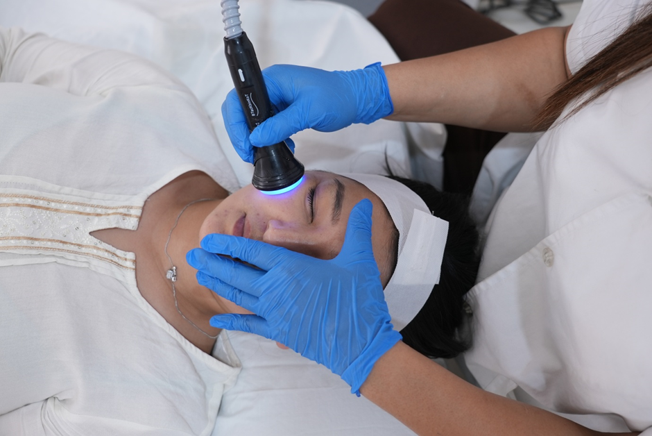 Treatment for Hyperpigmentation at Richardson Face Hospital, Bangalore