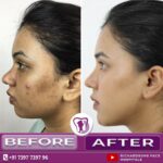 Facemakeover