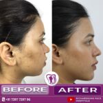 Facemakeover