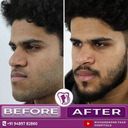 02 Orthognathic Surgery 1