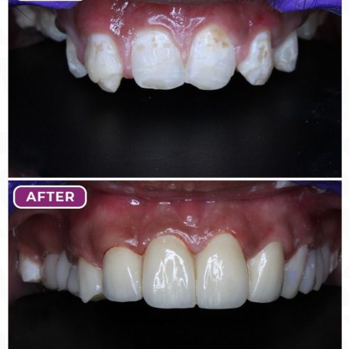 03 Smile Design 1