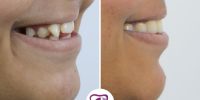 03 smile-design-images-05