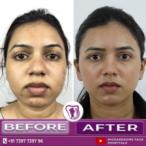 Facemakeover